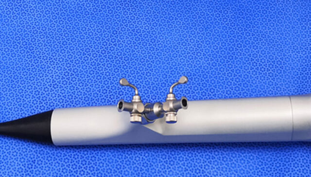 تفتيت وعلاج حصوات الحالب بالمنظار المرن