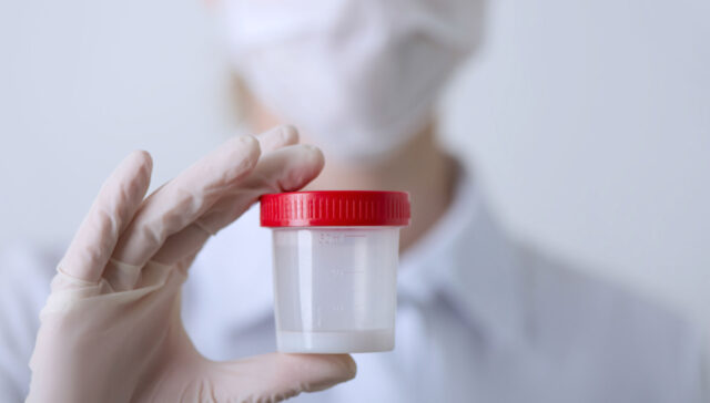 السائل المنوي