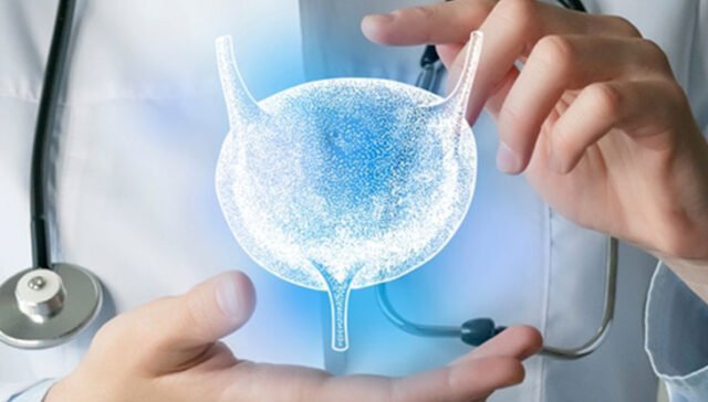 سرطان المثانة