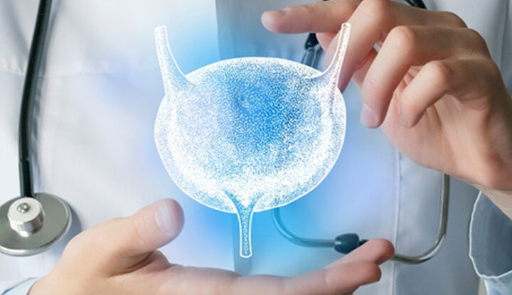 سرطان المثانة