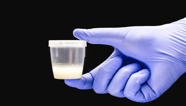 تحليل السائل المنوي