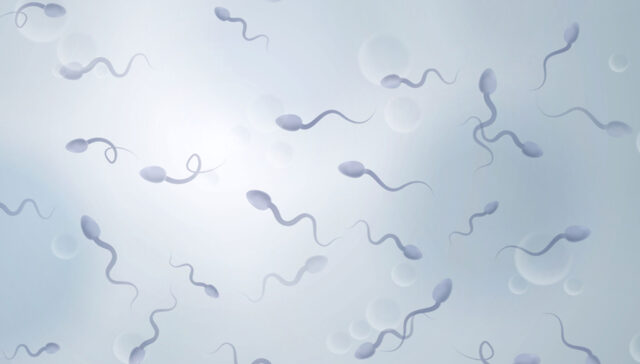 مشاكل الحيوان المنوي وعلاج مشاكل الحيوان المنوى