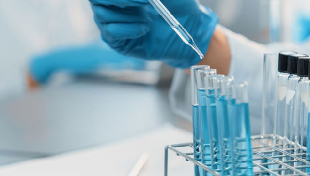 فحوصات الخصوبة للرجال