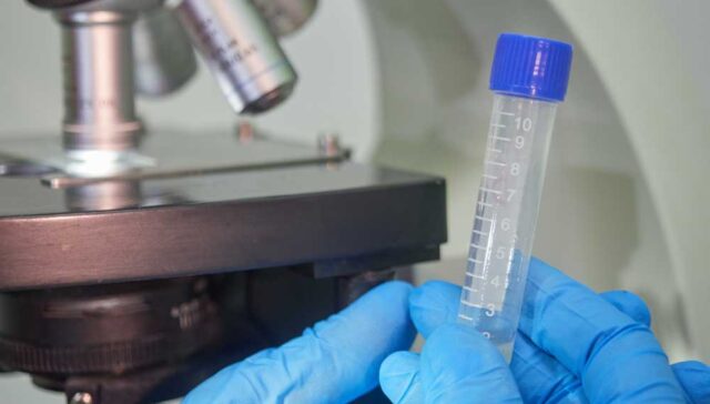 وجود دم في السائل المنوي