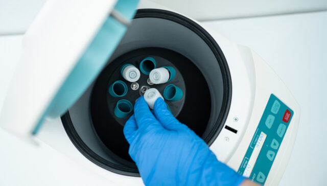 العلاجات الحديثة لعقم الرجال