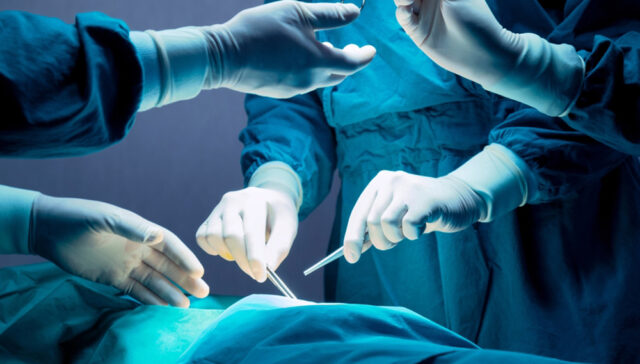 عملية دوالي الخصية