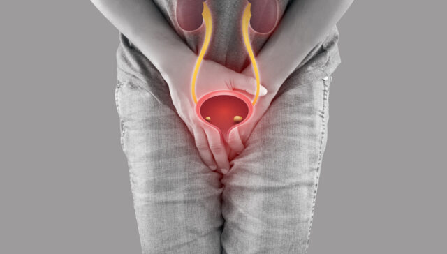 التهاب الحالب