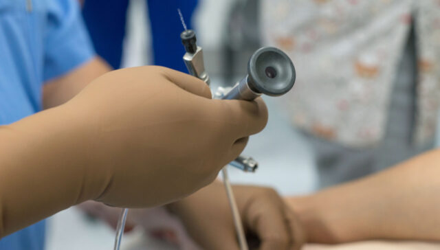 منظار المثانة